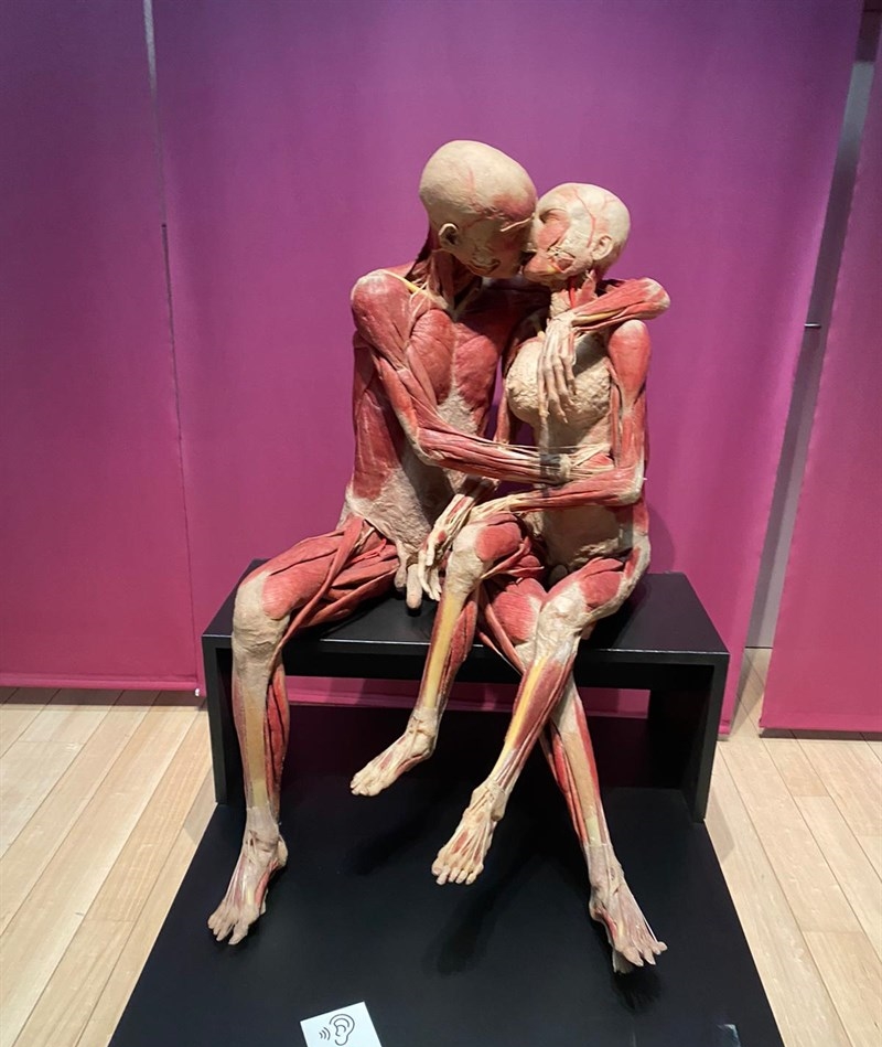Il bacio Il bacio