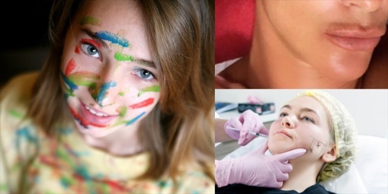 Chirurgia estetica nei giovani Chirurgia estetica nei giovani