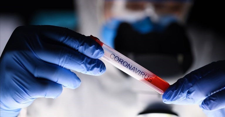 Coronavirus Coronavirus